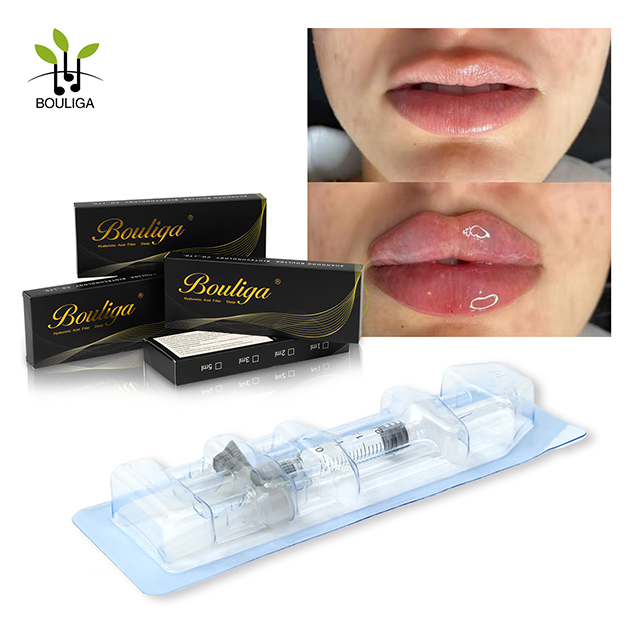 Rellenos de labios voluminizadores y naturales con resultados duraderos