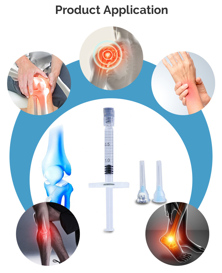 gel médico del ácido hialurónico de la inyección de la articulación de rodilla no reticulada 2ml