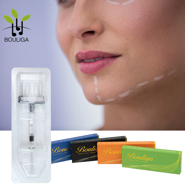 Rellenos faciales para mejorar el contorno y aumentar el mentón