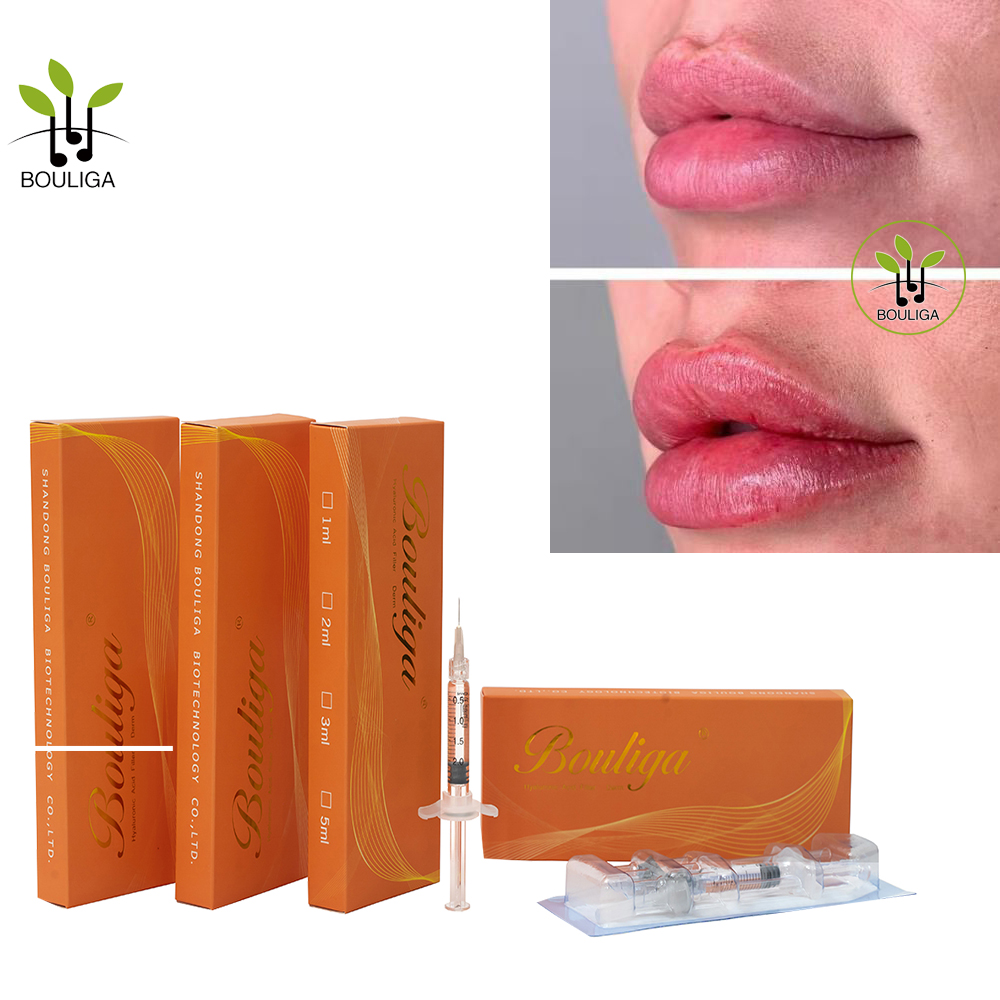 Relleno dérmico Bouliga para labios hermosos 1ml 2ml 5ml