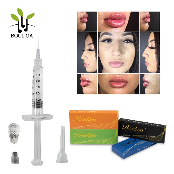 Inyectable1ml 2ml 3ml 5ml Inyecciones de ácido hialurónico reticulado Relleno dérmico/Ha Filler para labios, nariz, arrugas, senos, glúteos, cuerpo, cara, cuello, pliegues