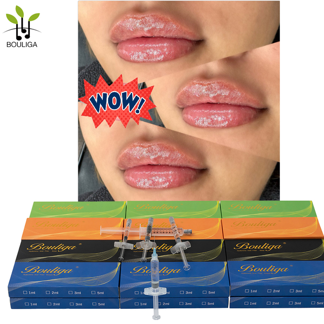 Bouliga Dermal filler 2ml 100% ácido hialurónico 20mg/ml concentración para Lip Glow Up